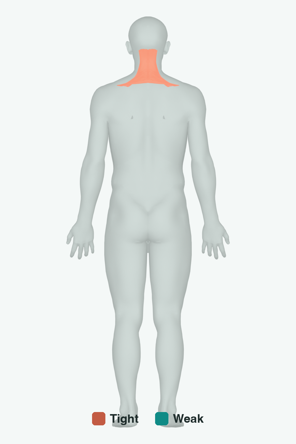 Muscles involved in Head Rotation, back view — typically tight muscles in coral, typically weak in teal
