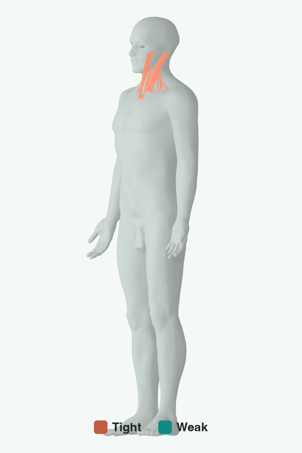 Muscles involved in Head Tilt, front view — typically tight muscles in coral, typically weak in teal