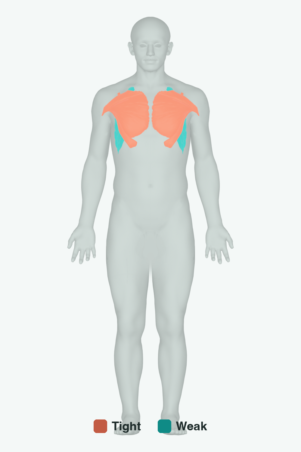 Muscles involved in Rounded Shoulders, front view — typically tight muscles in coral, typically weak in teal