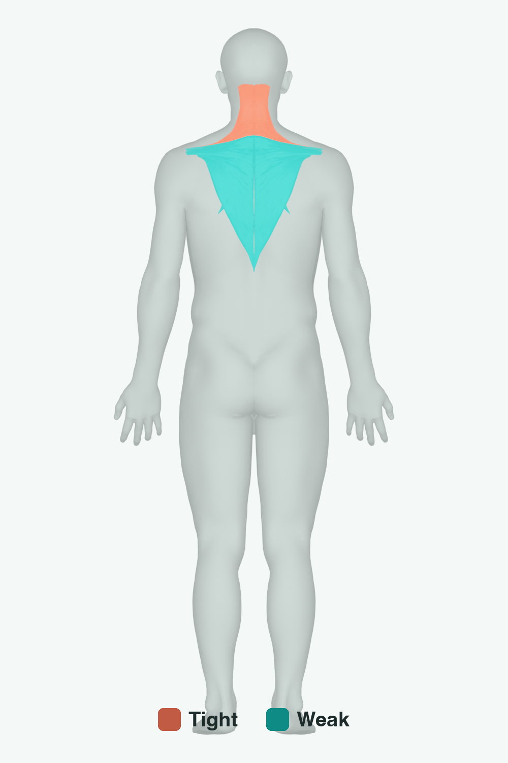 Muscles involved in Rounded Shoulders, back view — typically tight muscles in coral, typically weak in teal