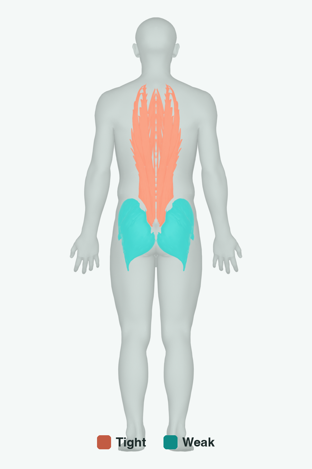 Muscles involved in Trunk Lean, back view — typically tight muscles in coral, typically weak in teal