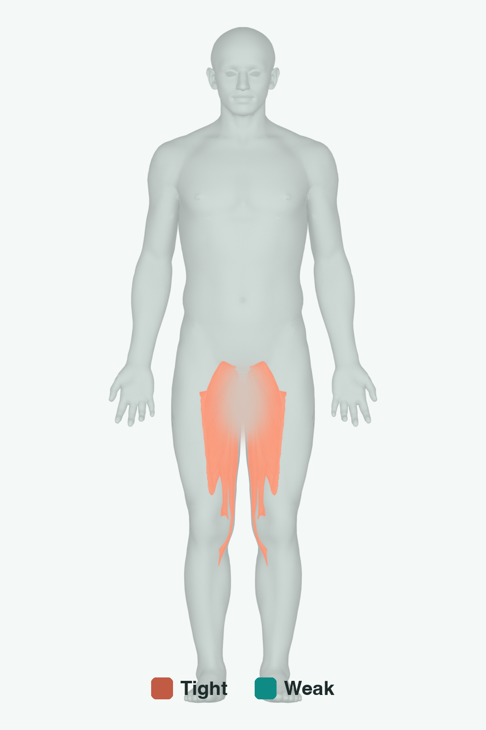 Muscles involved in Uneven Hips, front view — typically tight muscles in coral, typically weak in teal