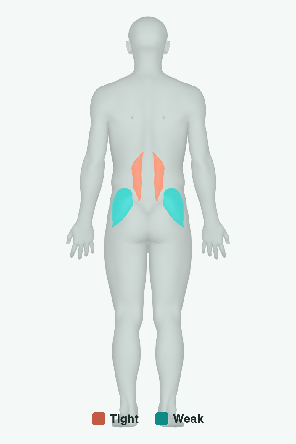 Muscles involved in Uneven Hips, back view — typically tight muscles in coral, typically weak in teal